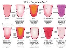 How Tongue Diagnosis Works By Transformational Acupuncture