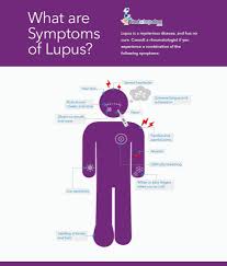 what are the signs and symptoms of lupus