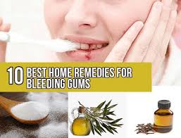 home remes for bleeding gums
