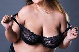 How Huge Breasts Can Affect Quality of Life | Plastic Surgeon Albany