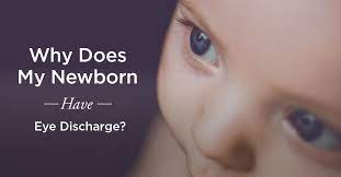 newborn eye discharge why does this