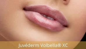 juvederm volbella xc lip injection gel