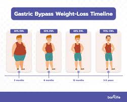 gastric byp weight loss chart