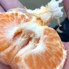the white fuzz inside your clementine