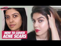 how to cover acne scars pimple marks