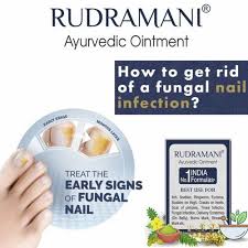 nail fungus treatment rudramani ointment