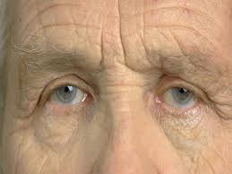 why second eye cataract surgery is