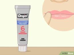 6 ways to get rid of a cold sore wikihow