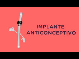 Además, el implante suele inhibir la ovulación. Todo Lo Que Debes Saber Sobre El Implante Anticonceptivo Youtube