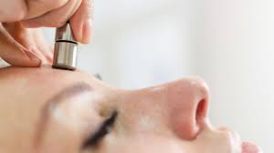 why microdermabrasion treatments are on