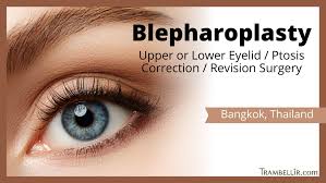 blepharoplasty upper or lower eyelid