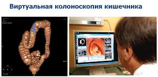 We did not find results for: Virtualnaya Kolonoskopiya Provedenie Procedury Ee Plyusy I Minusy