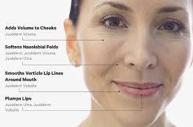 Filler is used for temporary elimination of wrinkles and augmentation of lips, chin or cheeks by injecting a colorless and transparent gel like product containing stabilized non animal based hyaluronic acid inside the skin. Juvederm Faqs What It Does Cost More