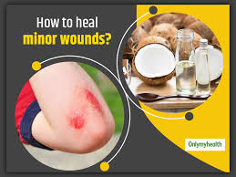 natural remes to heal minor wounds