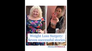 weight loss surgery abroad