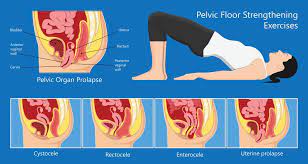 pelvic floor muscle exercises aare