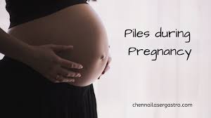 how to cope with piles during pregnancy