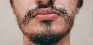patchy mustache how to fix thin stache