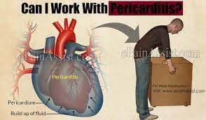 Other tests used to diagnose pericarditis include: Can I Work With Pericarditis
