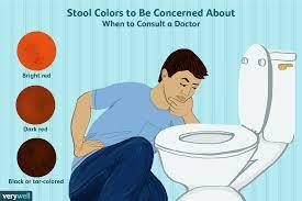stool color changes what s normal and