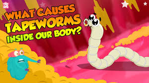 tapeworm infection
