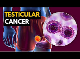 testicular cancer causes signs and