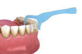 brushing and flossing causes bleeding gums