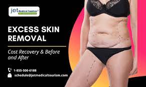 excess skin removal surgery cost