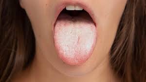 your tongue suddenly taste sour expert
