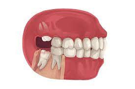 Corvallis Dental Group gambar png