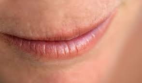 cure dry lips best lip treatments