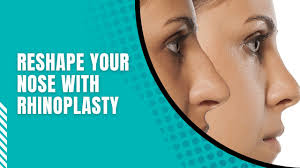 reshape your nose with rhinoplasty