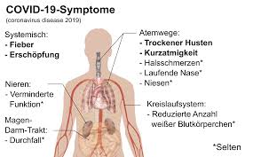 Most people will have mild symptoms and get better on their own. Datei Symptoms Of Coronavirus Disease 2019 German Svg Wikipedia