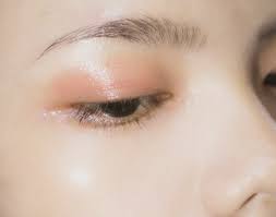 why the asian eyelid lift is no longer