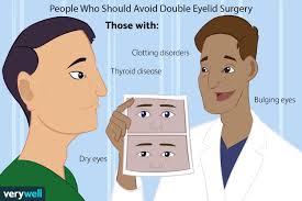double eyelid surgery purpose