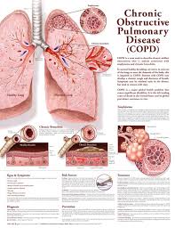 20x26 Chronic Obstructive Pulmonary Disease Copd Anatomical Chart 2nd Edition Poster Print