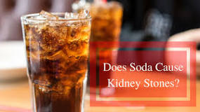 What drinks give you kidney stones?