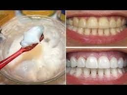 Baking soda is a popular teeth whitening method. 8 Day Whiten Teeth With Baking Soda And Coconut Oil Youtube