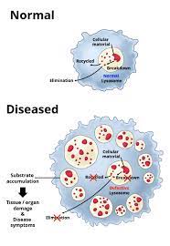 lysosomal disorders avrobio
