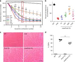 loss of peroxiredoxin 2 exacerbates