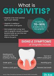 gingivitis symptoms and how to get rid