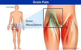 I am 5 weeks pregnant(i think) and for the past 3 days i have been having this sharp pain in groin/pelvic area, only on the right side. Groin Pain Types Symptoms Causes Treatment
