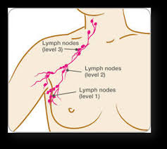 surgery on the axillary lymph nodes