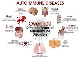 Una malattia autoimmune è una condizione che si verifica quando il sistema immunitario attacca erroneamente e distrugge i tessuti del corpo sano. Malattie Autoimmuni Cosa Sono Perche Stanno Aumentando E Come Difendersi Dottor Giuseppe Bova