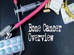 However… whether you're trying to avoid cancer or beat it if you've got it, there is one very powerful antidote as it effects the plasma cells in the bone marrow which are part of the immune system, i am not sure if. What You Need To Know About Bone Cancer