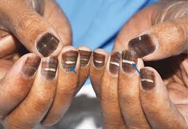 nail to turn brown