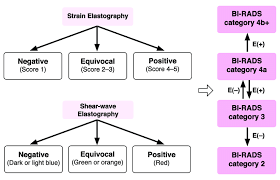 A Flowchart Showing The Combination Of B Mode And