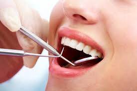 teeth cleaning in the philippines
