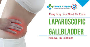laparoscopic gallbladder removal