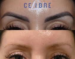 permanent makeup removal before after